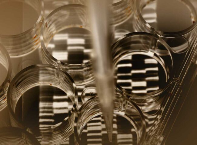 In a compelling High Court decision that has stirred conversations across both the legal and familial landscapes, a £14.5 million trust dispute between two brothers has culminated in a judgment that emphasizes intention over biology.